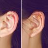 Star Clip On Earrings